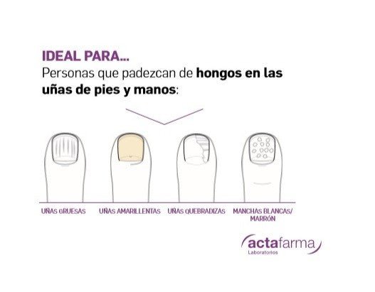 Ungeasil Tratamiento Antihongos Uñas Manos y Pies 3.5ml-2