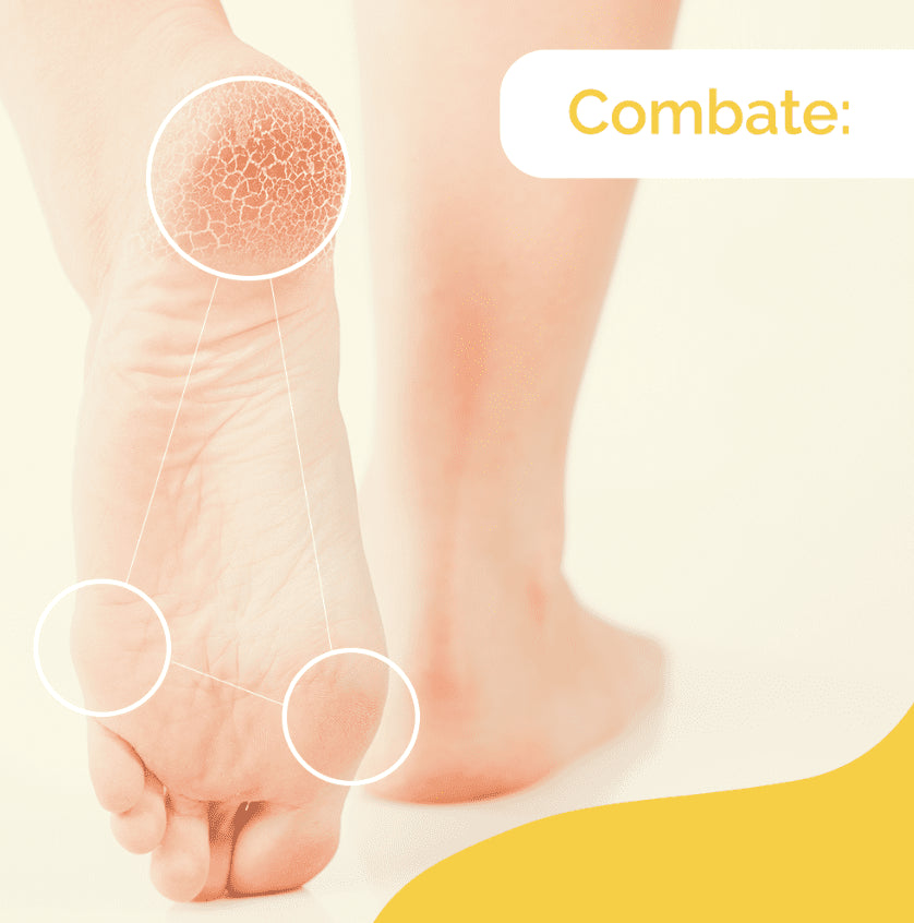 SCHOLL Crema Durezas Pies 60ml-5