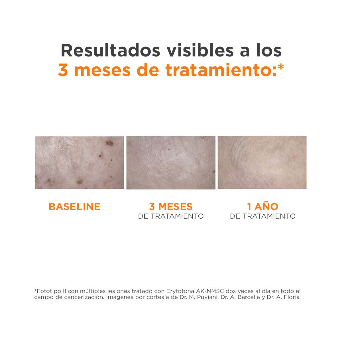 ISDIN Eryfotona AK-NMSC Fluid SPF 100+ 50ml-7