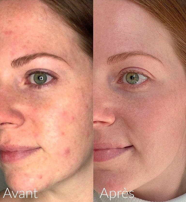 CAUDALIE Vinopure Sérum Salicílico Anti-Imperfecciones 30ml-4