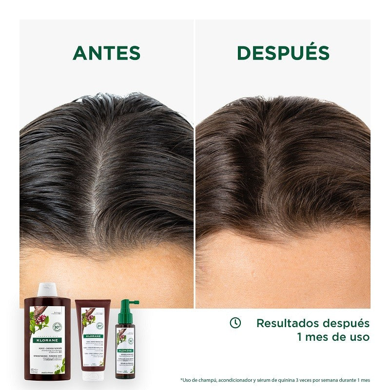 KLORANE Acondicionador a la Quinina y Edelweis BIO 200ml-5