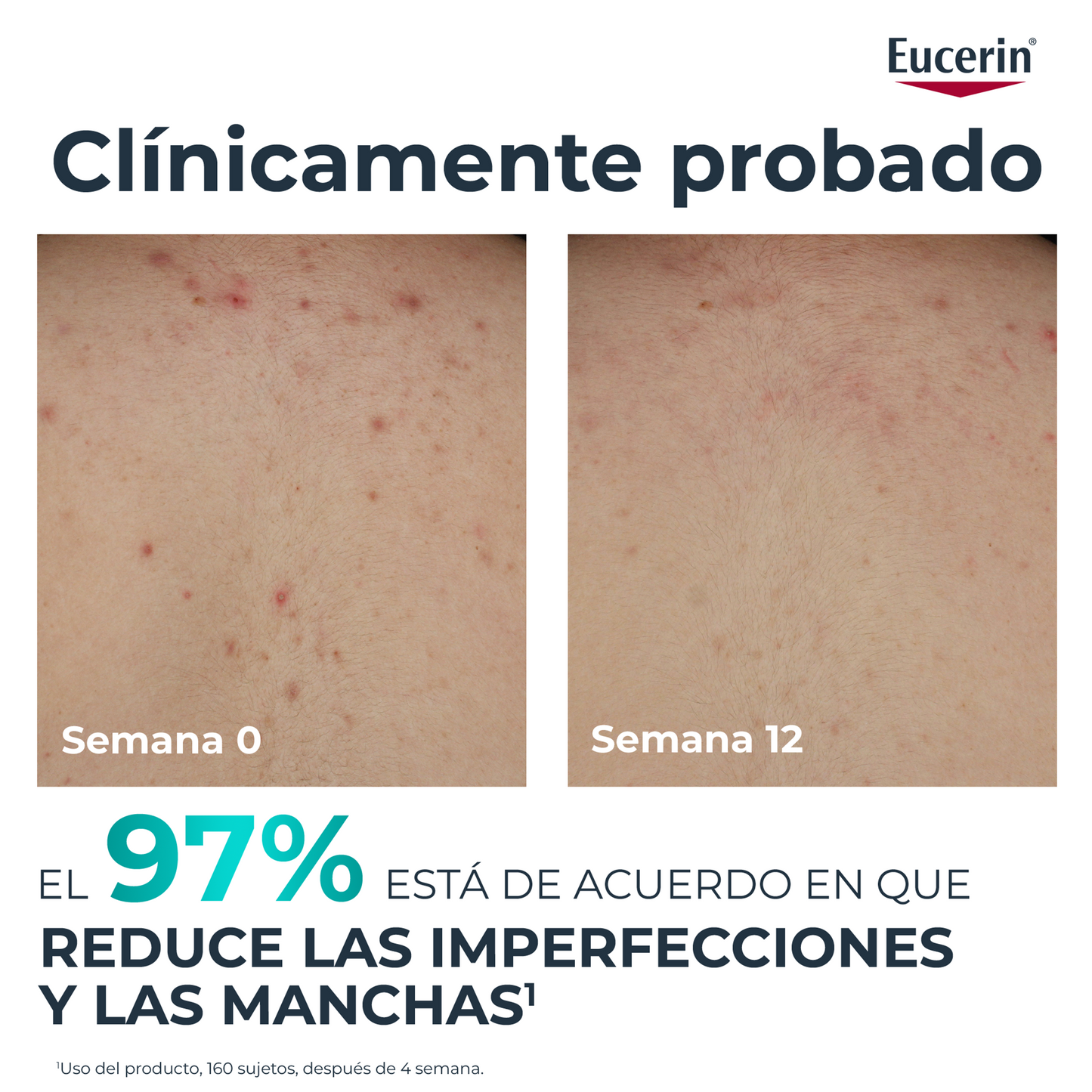Eucerin DermoPure Clinical Crema Corporal Correctora 200 ml