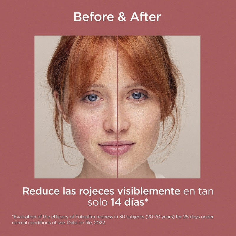 ISDIN FotoUltra Redness SPF 50+ (50ml)-9
