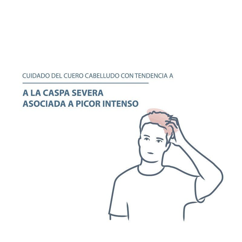 DUCRAY Kelual DS Champú Anticaspa 100ml-9