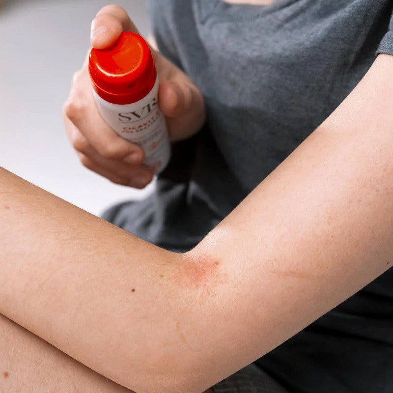 SVR Cicavit+ SOS Grattage 40ml-2