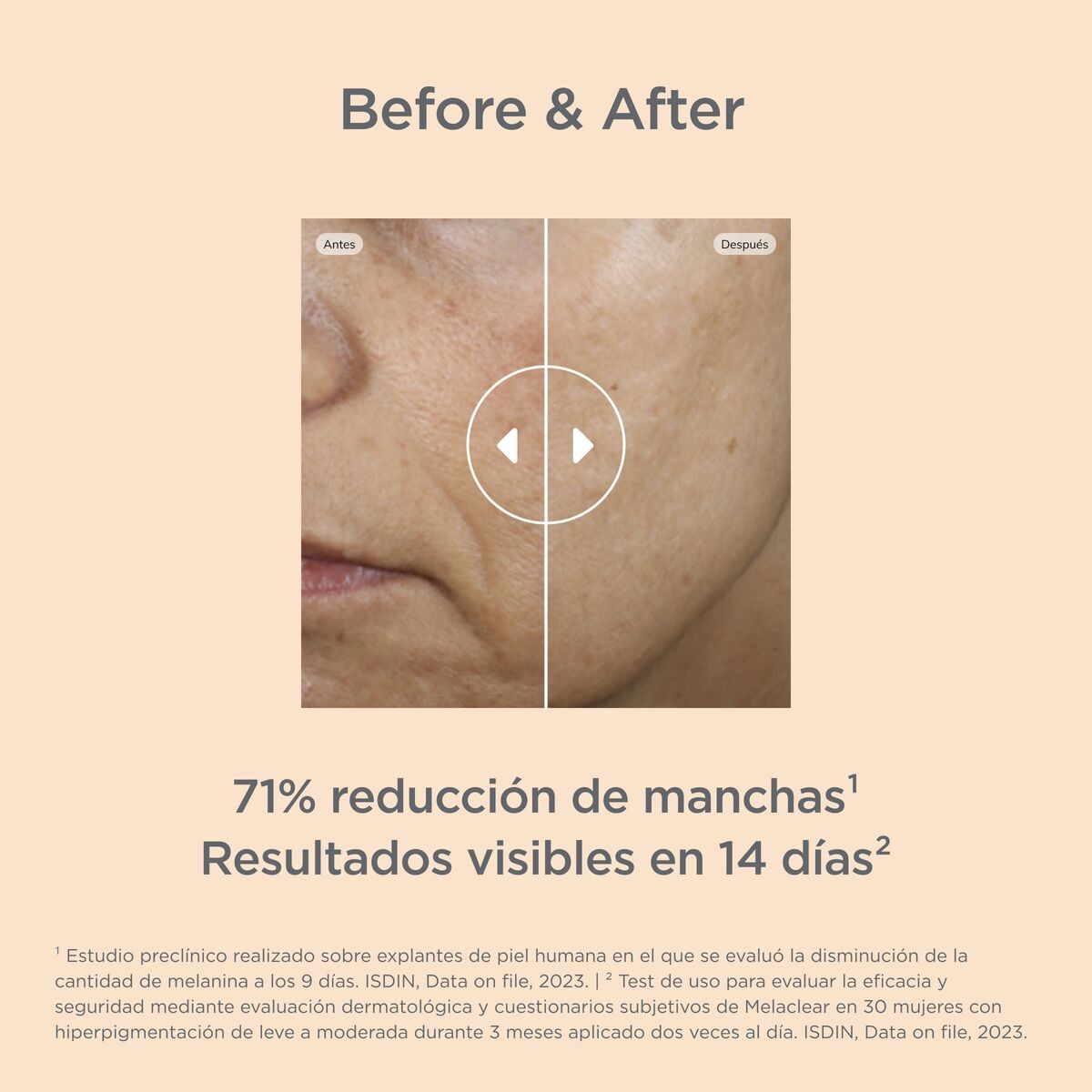 Isdinceutics Malaclear 1,8% 30 ml-4