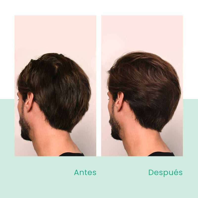 RENE FURTERER Triphasic Champú Estimulante Anticaída 200 ml-10