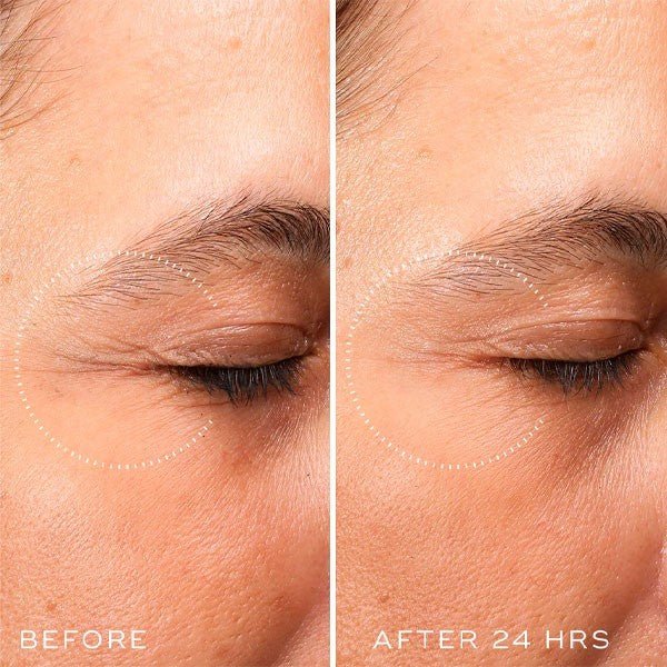 Medik8 Crystal Retinal Ceramide Eye 10 15 ml-3