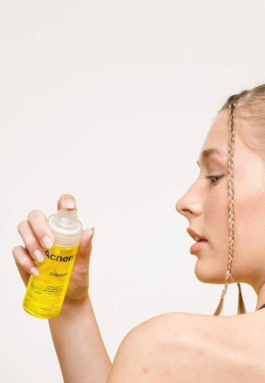 Acnemy Zitback 80 ml-5