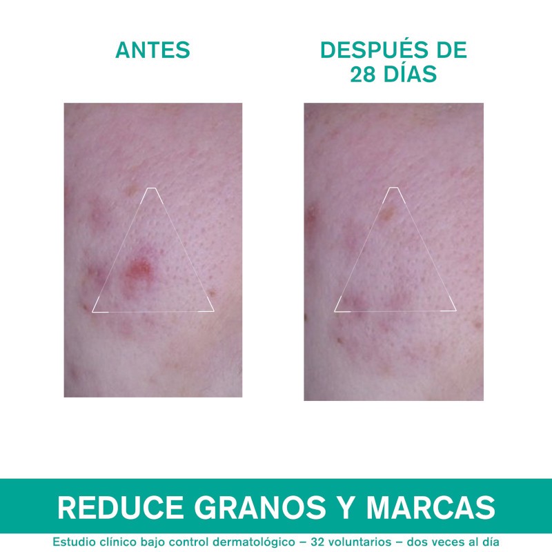 URIAGE Hyseac 3-Regul+ 40 ml-6