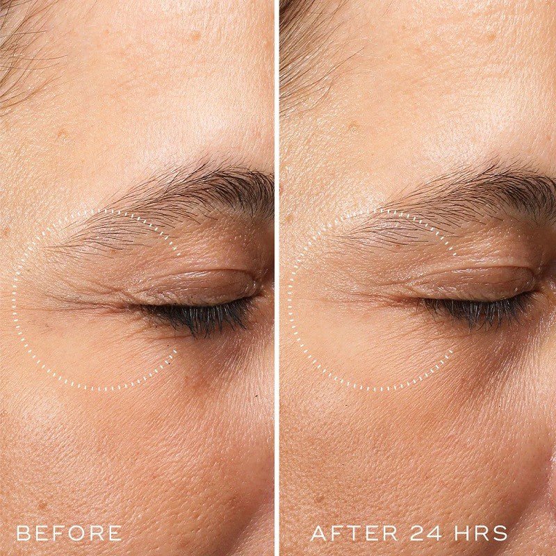 Medik8 Crystal Retinal Ceramide Eye 6 (15 ml)-6