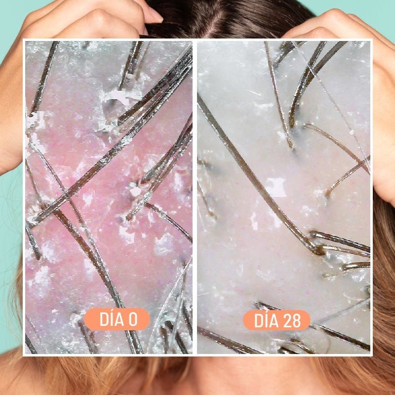 Freshly Cosmetics Dandruff & Scalp Exfoliating Treatment-6