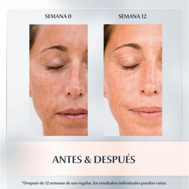 EUCERIN Anti-Pigment Dual Sérum 3x30ml【PACK AHORRO】-6