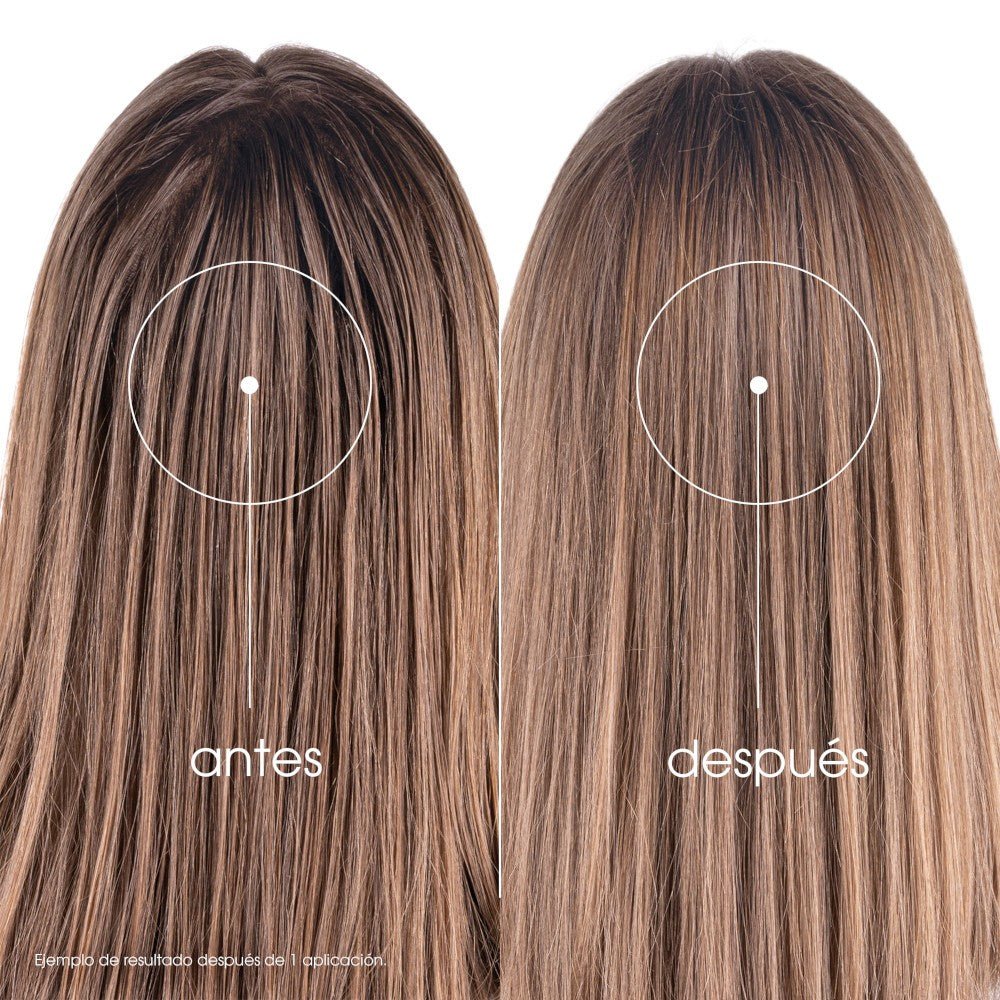 KLORANE Champú Seco a la Ortiga 150 ml-7