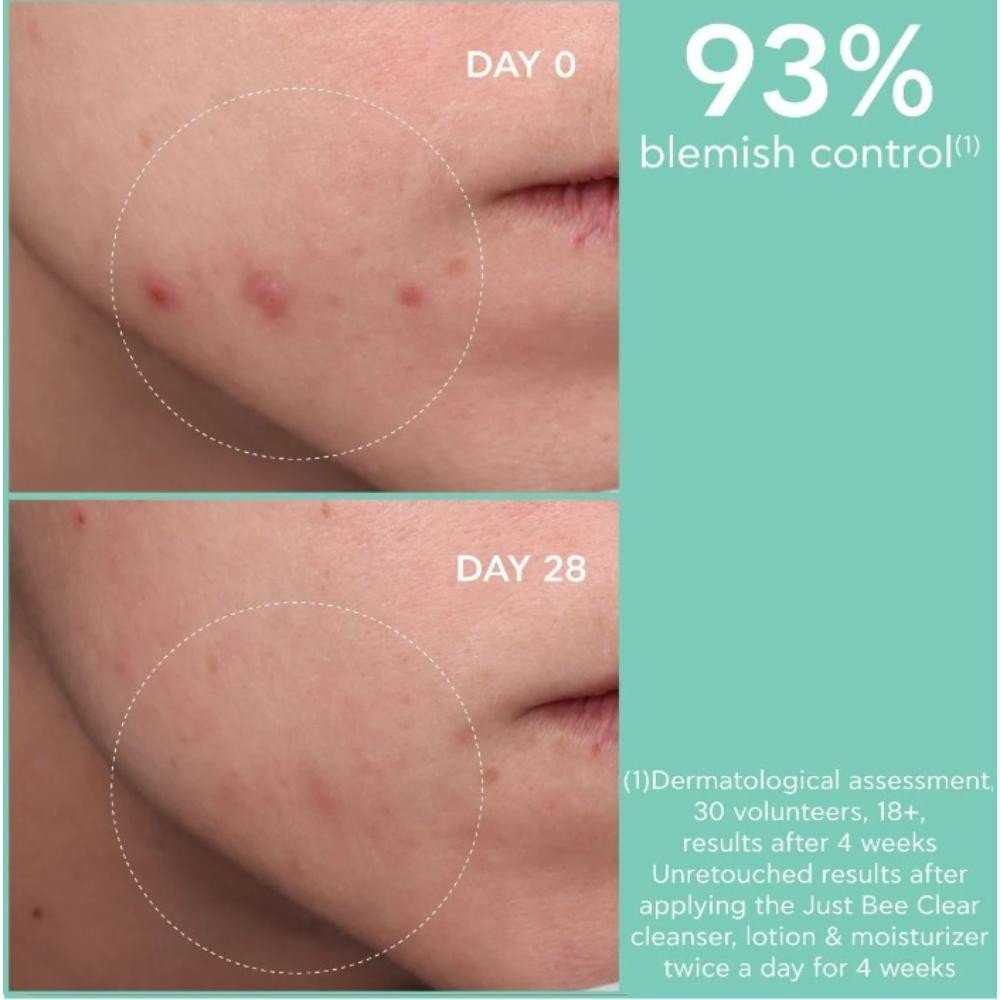 Apivita Just Bee Clear Gel Limpiador Purificante 200 ml-4