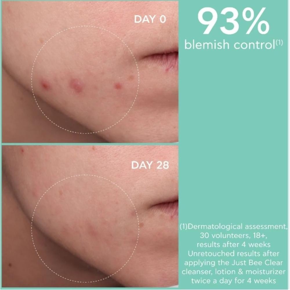 Apivita Just Bee Clear Loción Purificante Minimizadora de Poros 200 ml-4