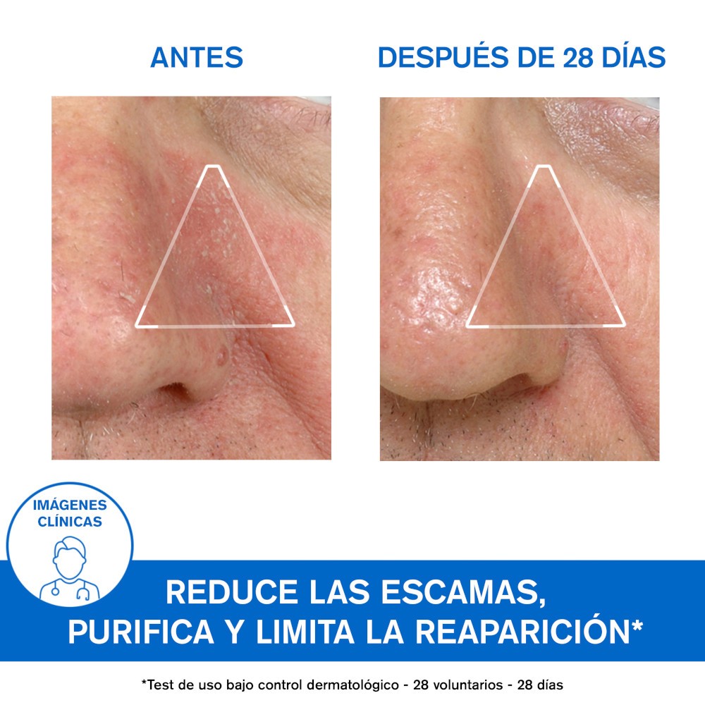 Uriage DS Emulsión 40 ml-4