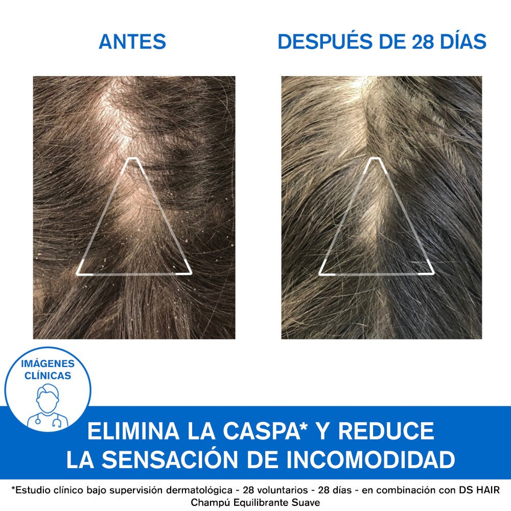 URIAGE DS Champú Anticaspa 200 ml-4