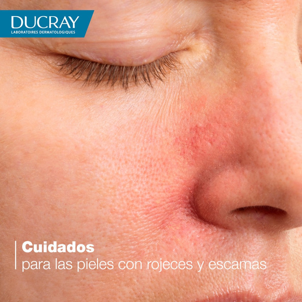 DUCRAY Kelual DS Crema Calmante Queratoreductora 40 ml-6