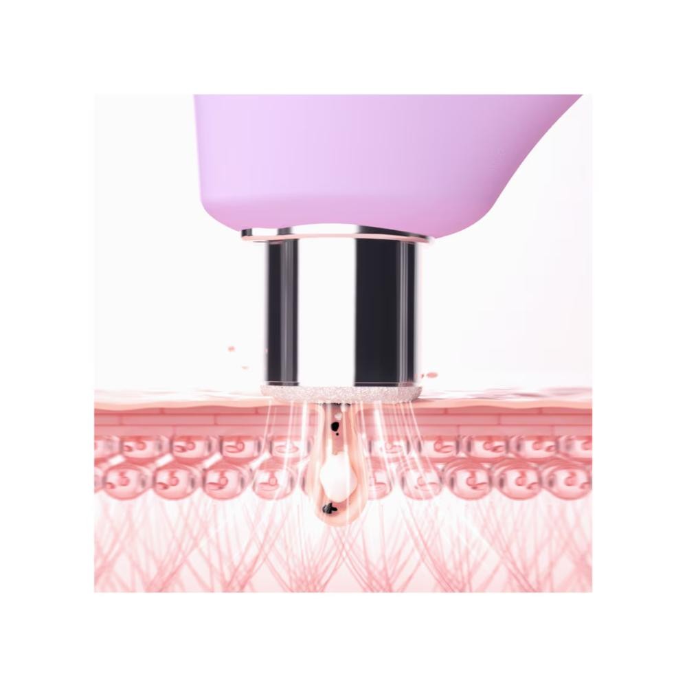 FOREO KIWI Derma Microdermoabrasión Avanzada 1 ud-3