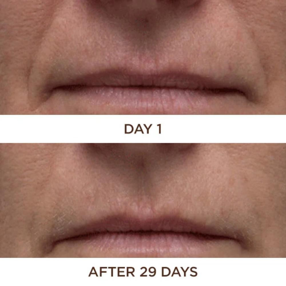 Perricone Cold Plasma Plus+ Face 30 ml-7