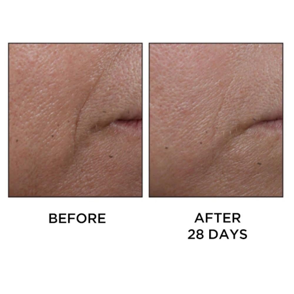 Perricone Cold Plasma Plus+ Face 30 ml-8