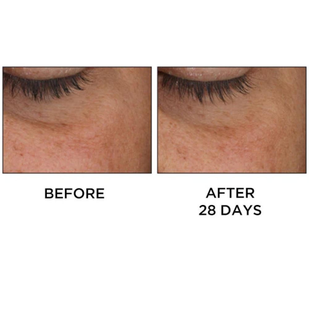 Perricone Cold Plasma Plus+ Eye 15 ml-7