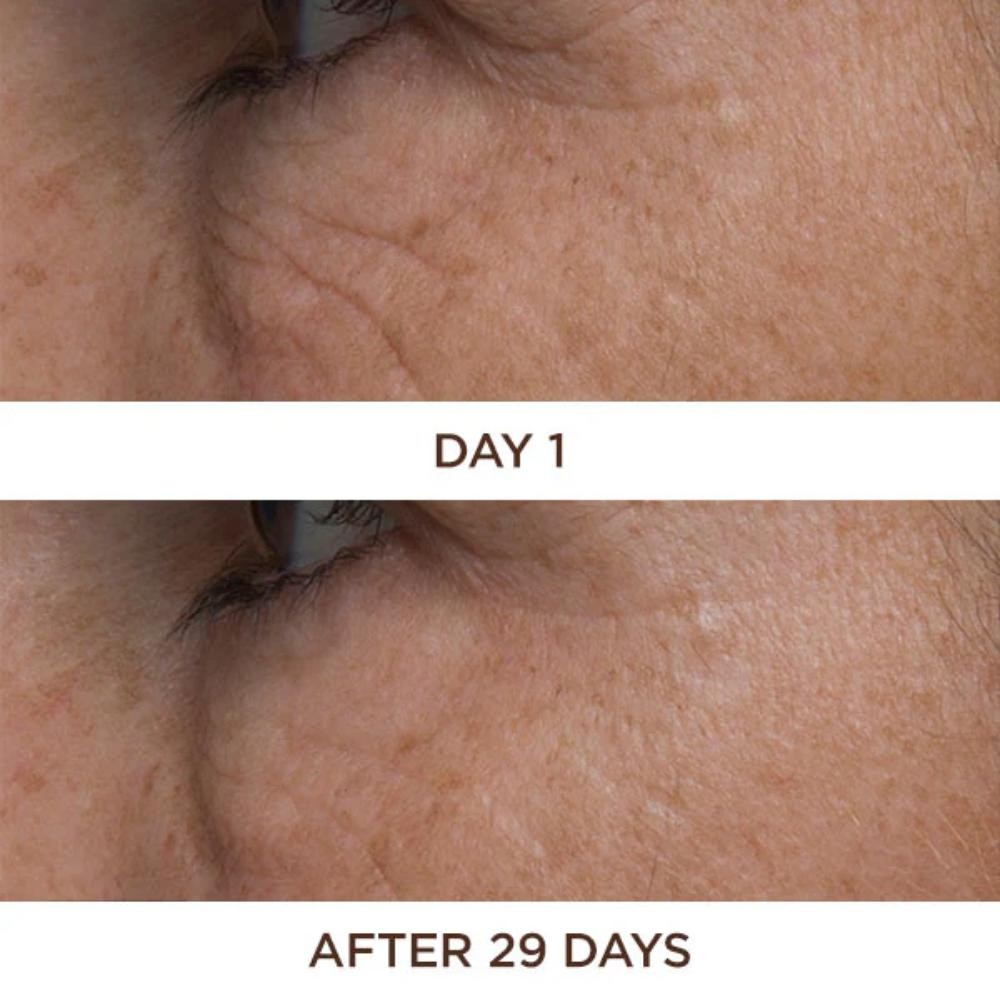 Perricone Cold Plasma Plus+ Eye 15 ml-8