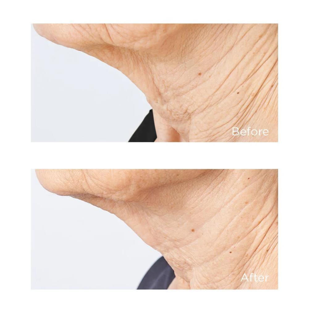 Perricone Cold Plasma Plus+ Sub-D/Neck 59 ml-7