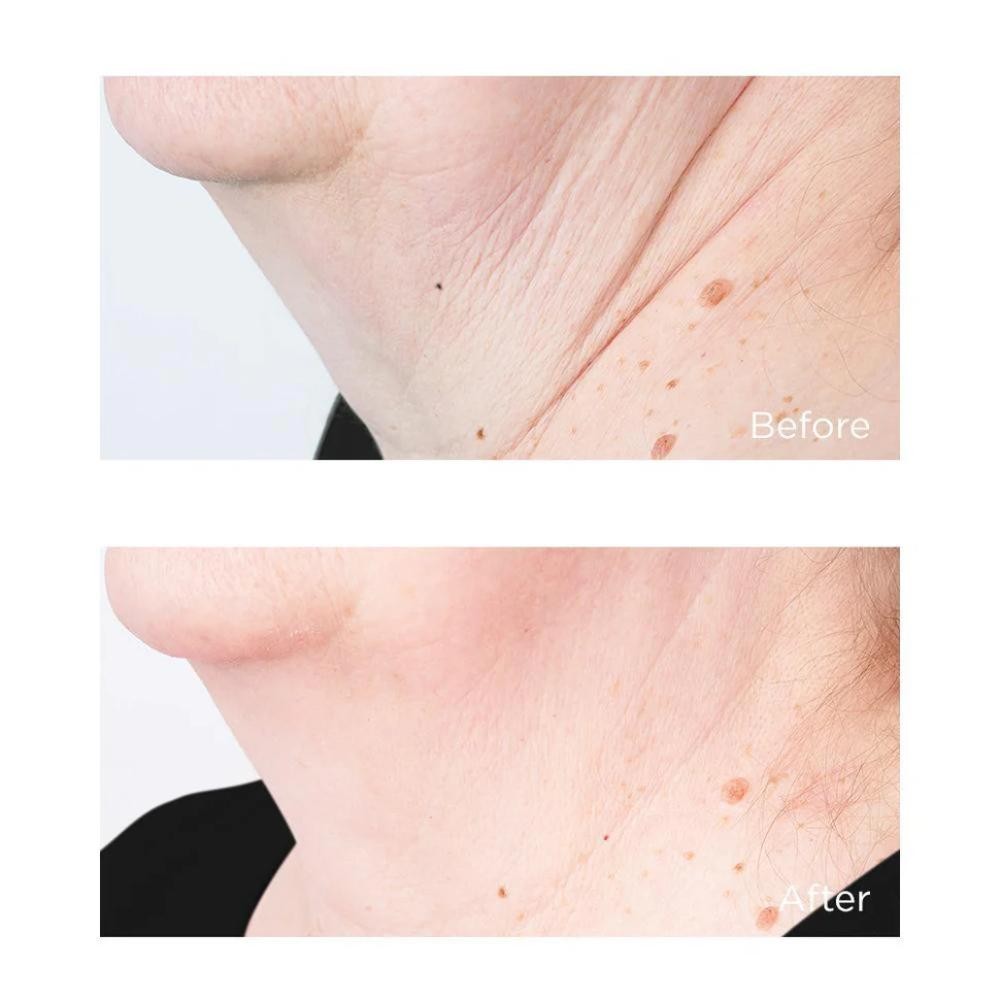 Perricone Cold Plasma Plus+ Sub-D/Neck 59 ml-8