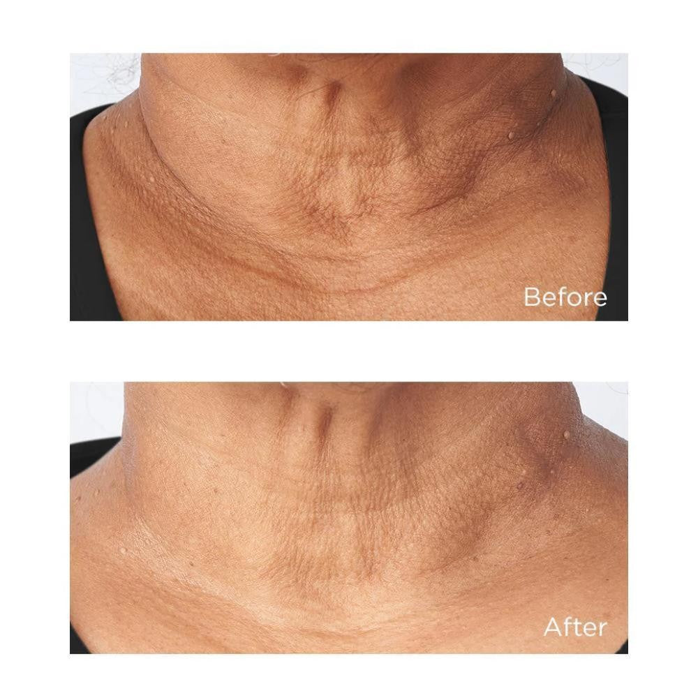 Perricone Cold Plasma Plus+ Sub-D/Neck 59 ml-9