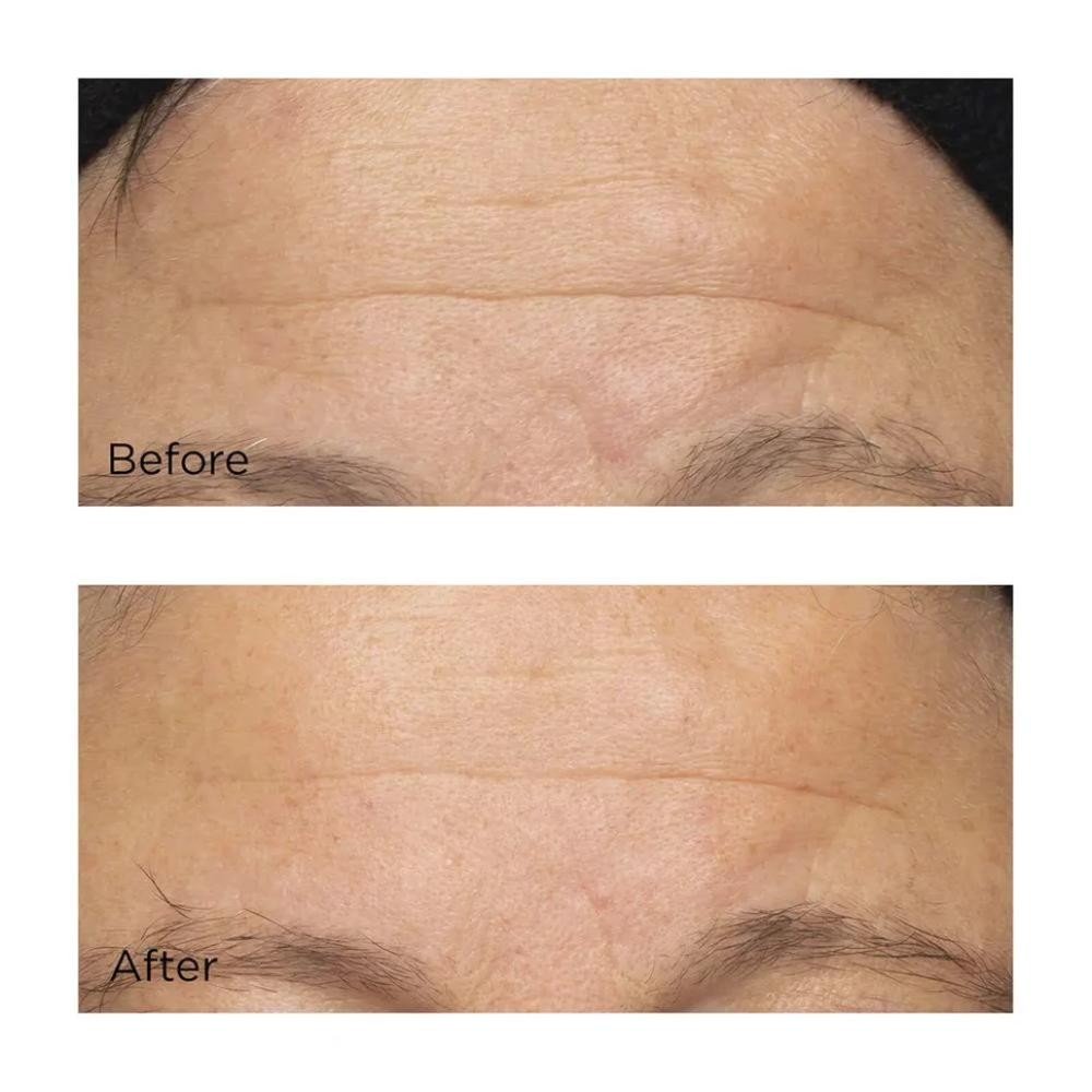 Perricone Cold Plasma Plus+ The Intensive Hydrating Complex 59 ml-8