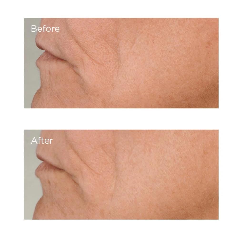 Perricone High Potency Growth Factor Firming & Lifting Serum 59 ml-4