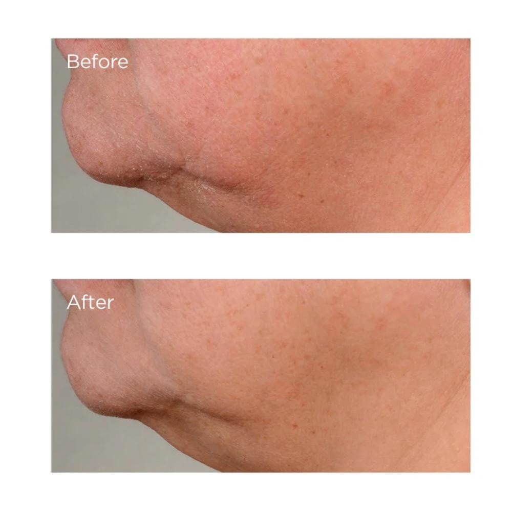 Perricone High Potency Growth Factor Firming & Lifting Serum 59 ml-5