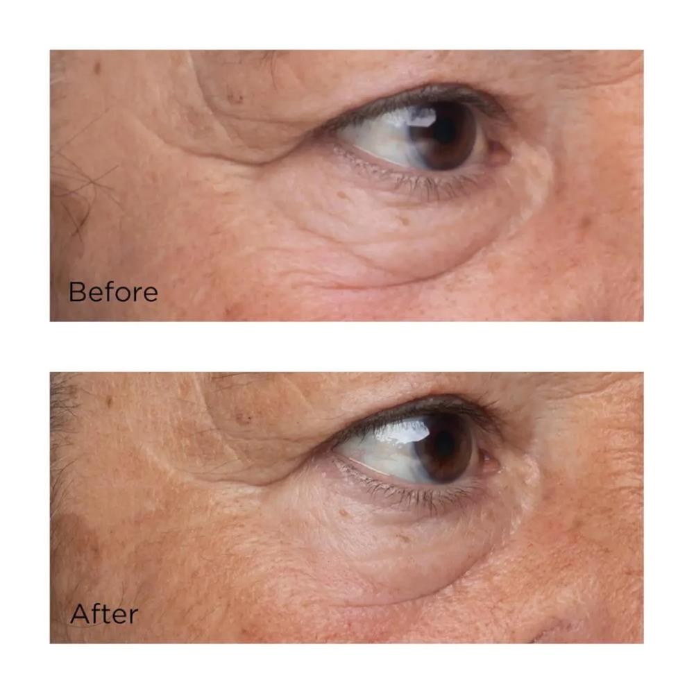 Perricone High Potency Growth Factor Firming & Lifting Eye Serum 15 ml-6