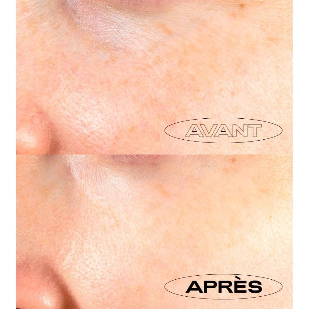 Patyka Fluido Antimanchas Alta Protección SPF30 40 ml-5