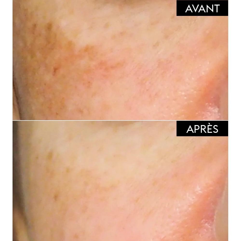 Patyka Pack Sérum Corrector Antimanchas 30 ml + Fluido Antimanchas Alta Protección SPF30 40 ml-8