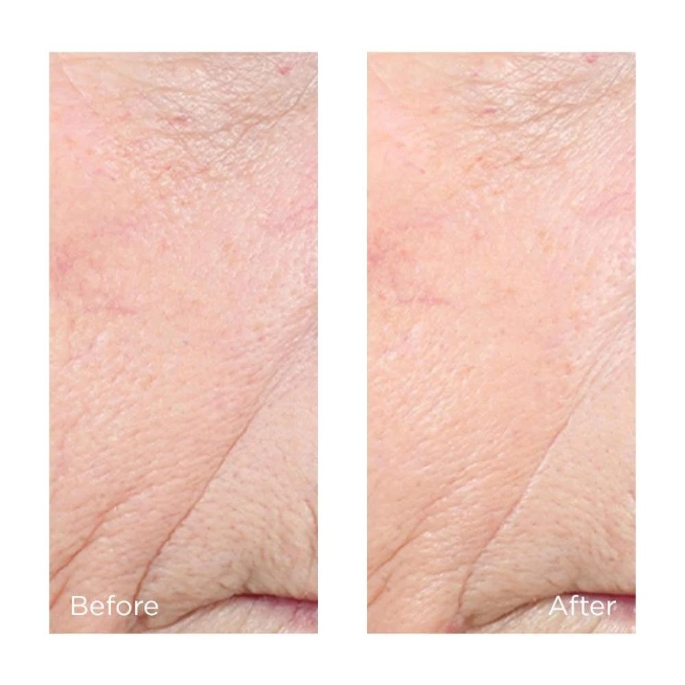 Perricone Vitamin C Ester CCC + Ferulic Brightening Complex 20% 59 ml-5