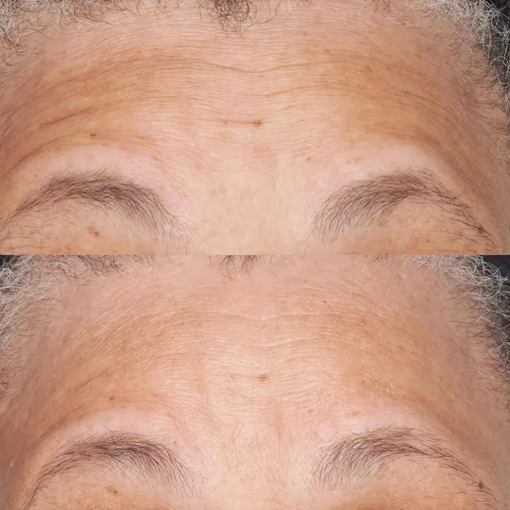 Perricone Hypoallergenic Clean Correction Barrier Repair Nourishing Moisturizer 59 ml-5