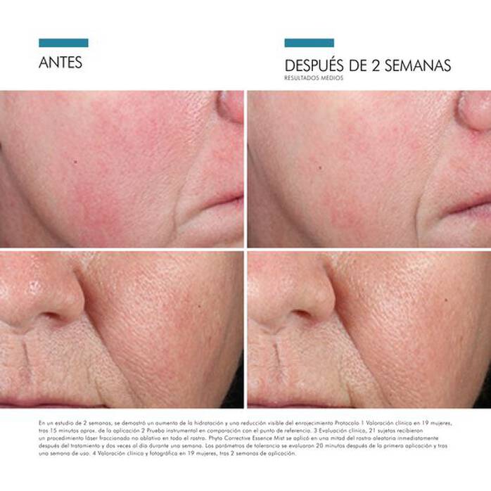 Skinceuticals Phyto Amp Essence Mist 50ml