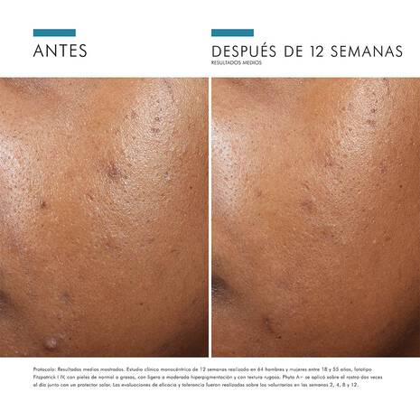 Skinceuticals Phyto A + 30ml