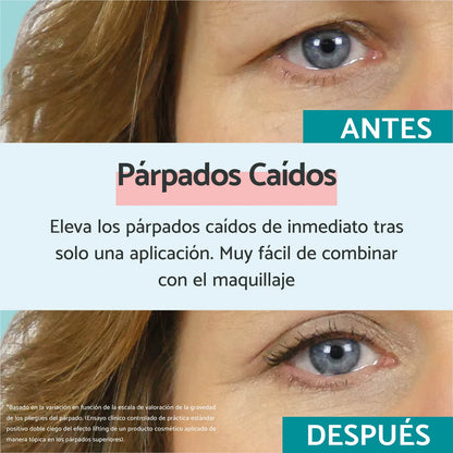 REMESCAR Droopy Eyelids 8ml