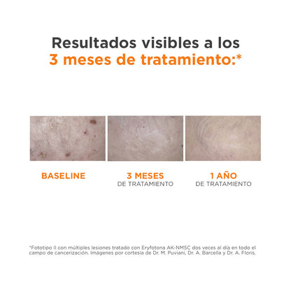 ISDIN Eryfotona AK-NMSC Fluid SPF 100+ 50ml-7