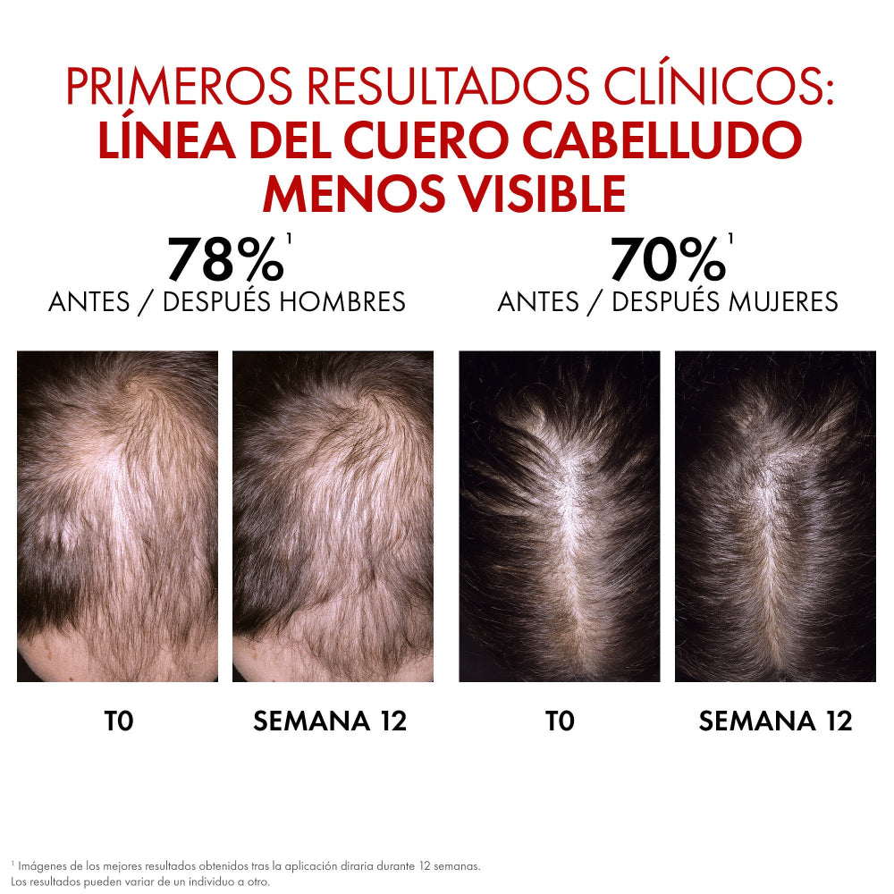 Vichy Dercos Aminexil Clinical R.E.G.E.N. Hair Booster Serum 90ml