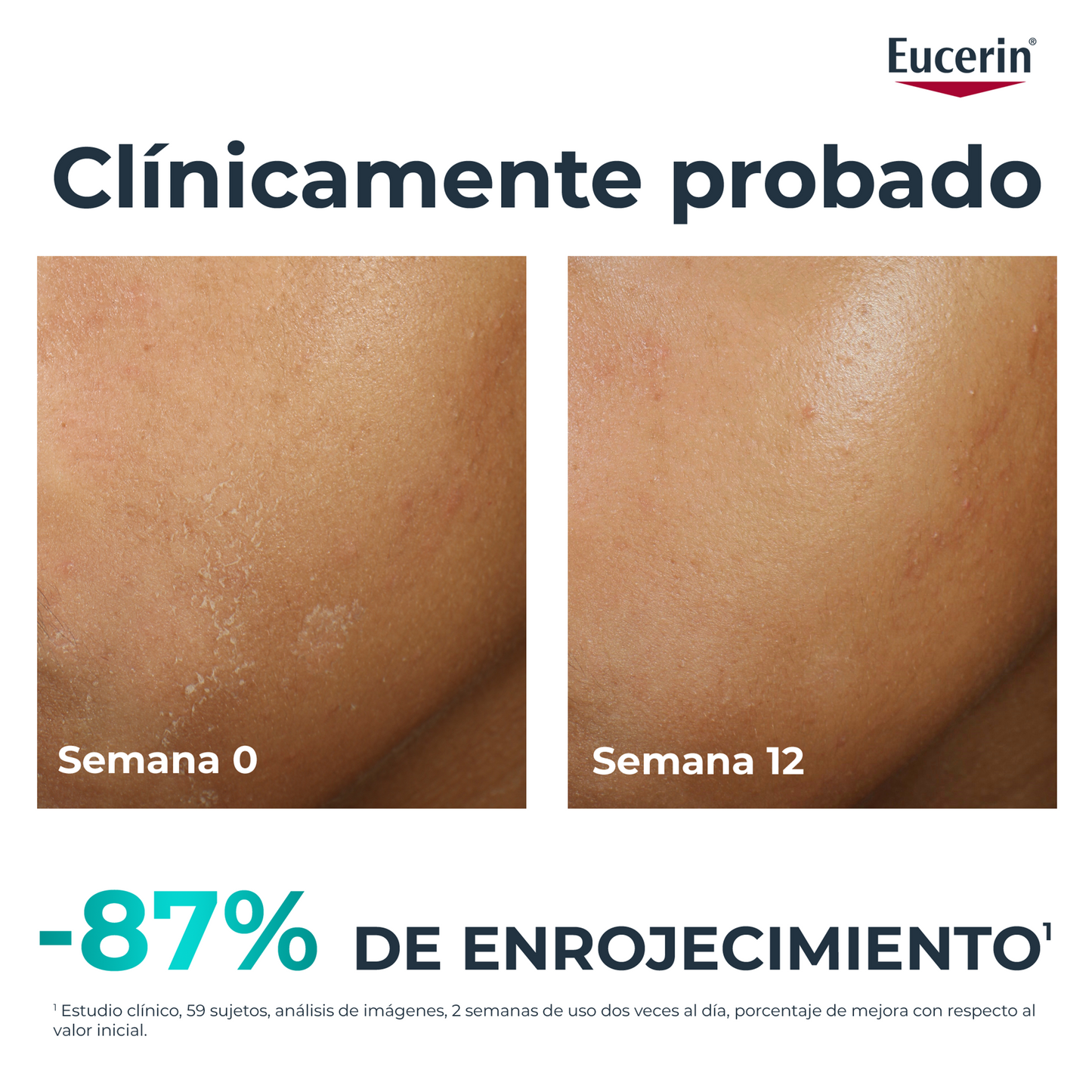 Eucerin DermoPure HydraRepair 40 ml