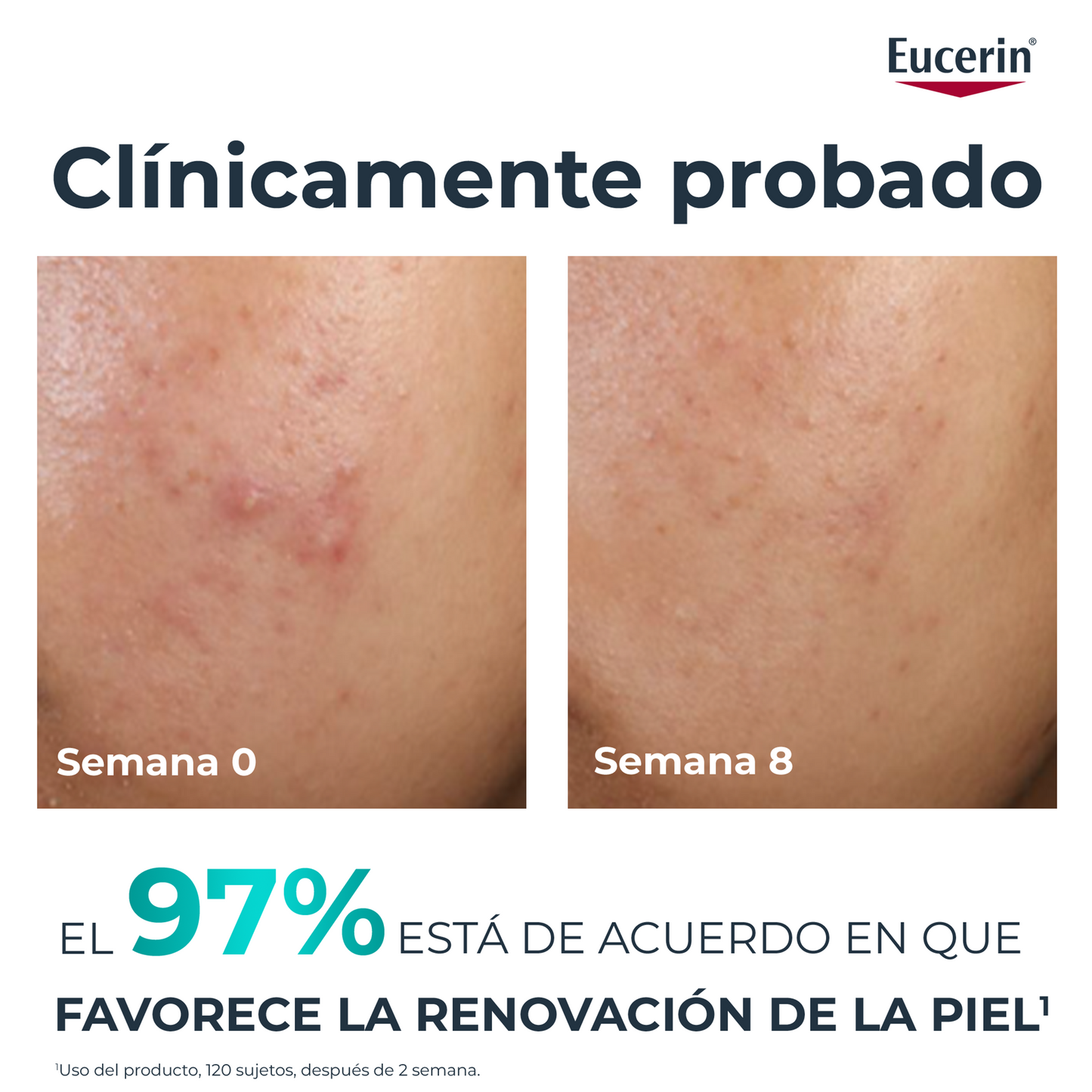 Eucerin DermoPure Oil Control 10% Hidroxiácidos 40ml