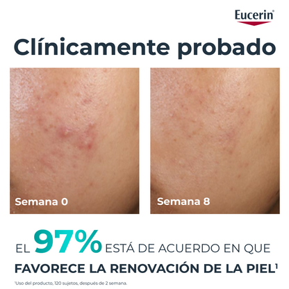 Eucerin DermoPure Oil Control 10% Hidroxiácidos 40ml