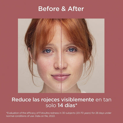 ISDIN FotoUltra Redness SPF 50+ (50ml)-9