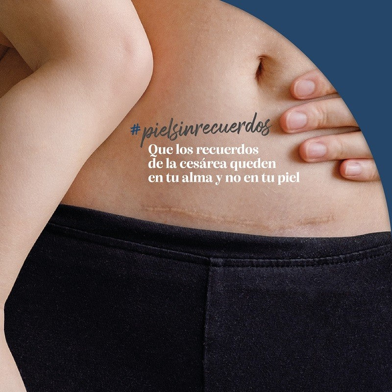 TROFOLASTIN Reductor de Cicatrices Mamario 3x2 parches