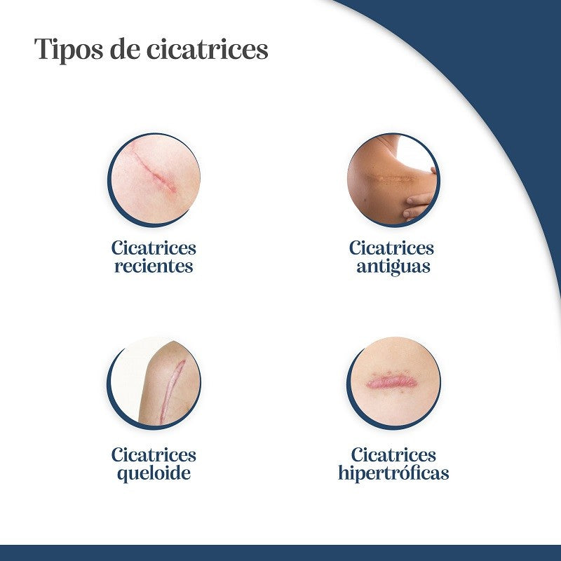 TROFOLASTIN Reductor de Cicatrices Mamario 3x2 parches